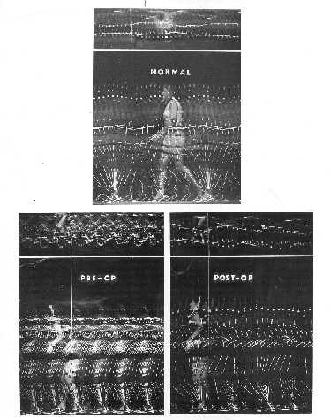 History of the Study of Locomotion